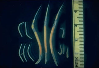 photo of male and female threadworms